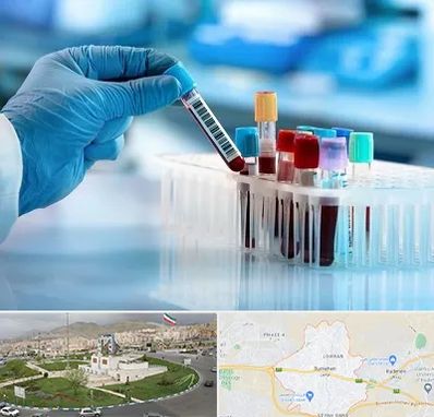 آزمایشگاه خون قبل از ازدواج در بومهن