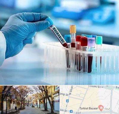 آزمایشگاه خون قبل از ازدواج در تربیت تبریز