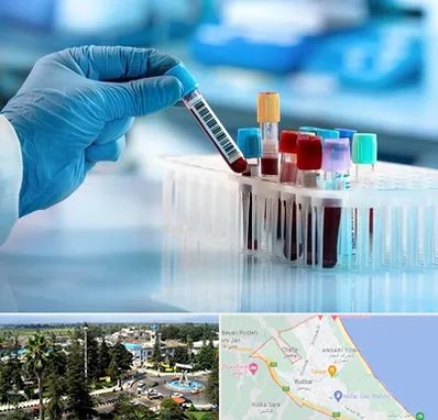 آزمایشگاه خون قبل از ازدواج در رودسر