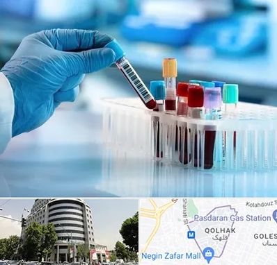 آزمایشگاه خون قبل از ازدواج در قلهک 