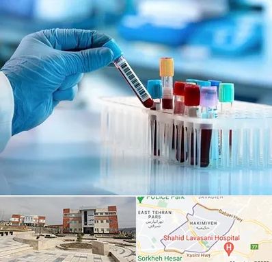 آزمایشگاه خون قبل از ازدواج در حکیمیه 