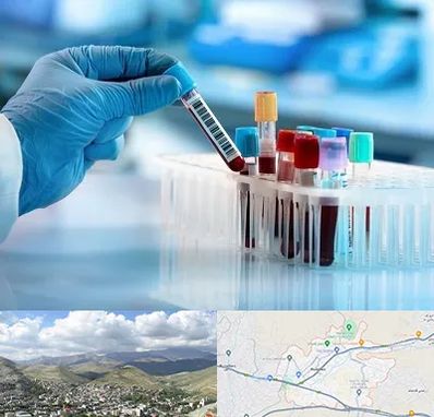 آزمایشگاه خون قبل از ازدواج در رودهن