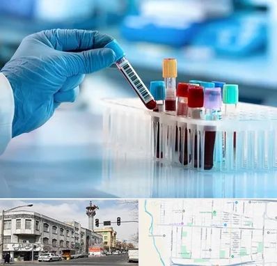 آزمایشگاه خون قبل از ازدواج در 17شهریور