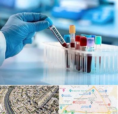 آزمایشگاه خون قبل از ازدواج در شهرک غرب مشهد