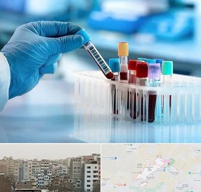 آزمایشگاه خون قبل از ازدواج در محمد شهر کرج