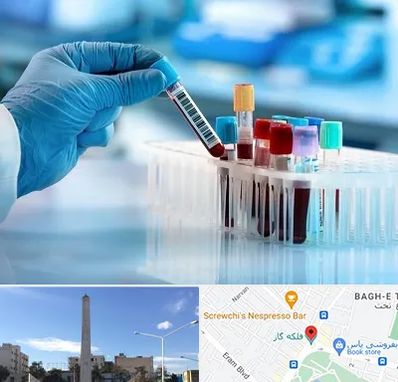 آزمایشگاه خون قبل از ازدواج در فلکه گاز شیراز