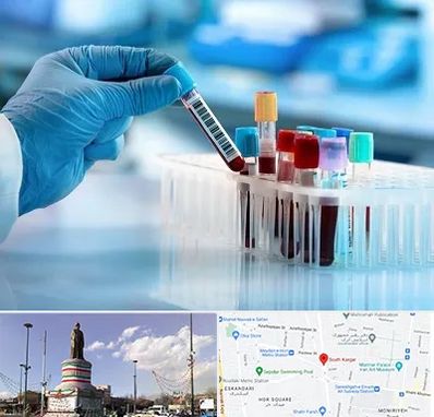 آزمایشگاه خون قبل از ازدواج در کارگر جنوبی 