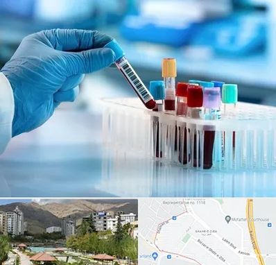 آزمایشگاه خون قبل از ازدواج در شهر زیبا 