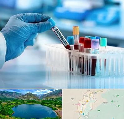 آزمایشگاه خون قبل از ازدواج در رودبار