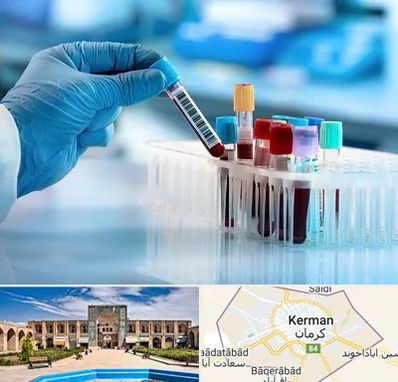 آزمایشگاه خون قبل از ازدواج در کرمان