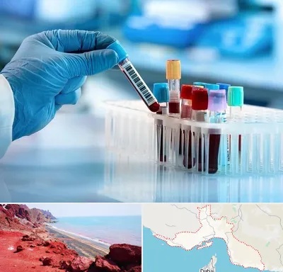 آزمایشگاه خون قبل از ازدواج در هرمزگان