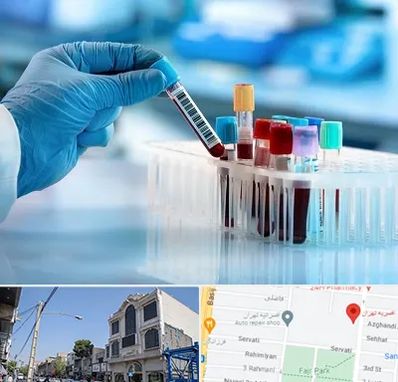 آزمایشگاه خون قبل از ازدواج در افسریه 