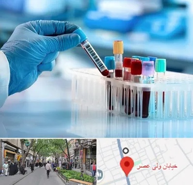 آزمایشگاه خون قبل از ازدواج در ولیعصر شهریار