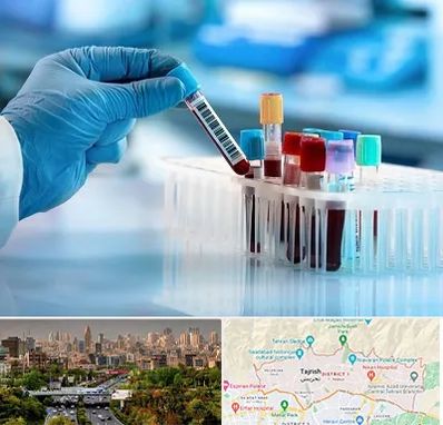 آزمایشگاه خون قبل از ازدواج در منطقه 1 تهران 