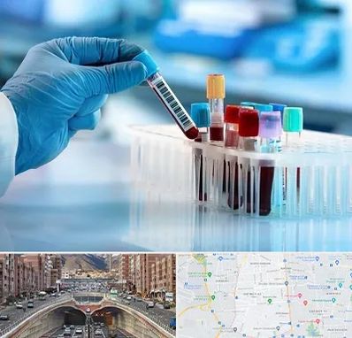 آزمایشگاه خون قبل از ازدواج در منطقه 10 تهران 