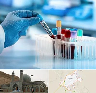 آزمایشگاه خون قبل از ازدواج در شهرضا