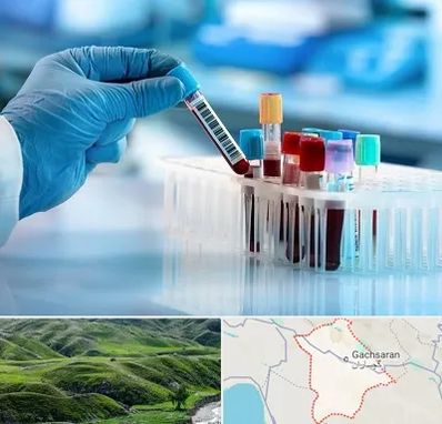 آزمایشگاه خون قبل از ازدواج در گچساران