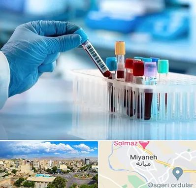 آزمایشگاه خون قبل از ازدواج در میانه
