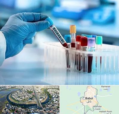 آزمایشگاه خون قبل از ازدواج در بابل