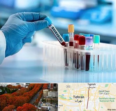 آزمایشگاه خون قبل از ازدواج در ولیعصر 