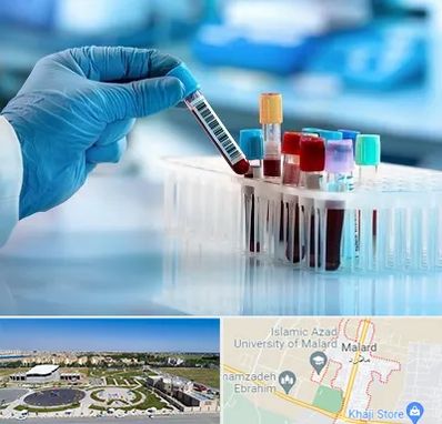 آزمایشگاه خون قبل از ازدواج در ملارد