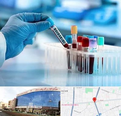 آزمایشگاه خون قبل از ازدواج در نصف راه تبریز