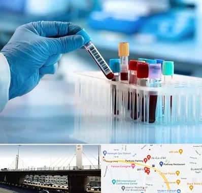 آزمایشگاه خون قبل از ازدواج در پارک وی 