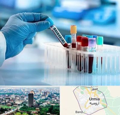 آزمایشگاه خون قبل از ازدواج در ارومیه