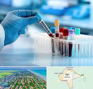آزمایشگاه خون قبل از ازدواج در ساری