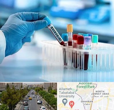 آزمایشگاه خون قبل از ازدواج در شهران 