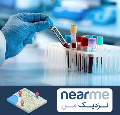 آزمایشگاه خون قبل از ازدواج در نزدیک من
