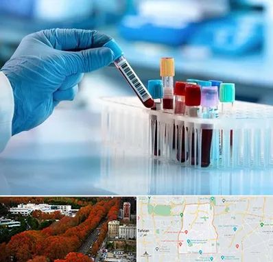 آزمایشگاه خون قبل از ازدواج در منطقه 6 تهران 
