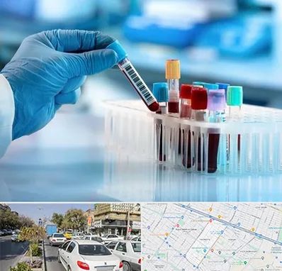 آزمایشگاه خون قبل از ازدواج در مفتح مشهد