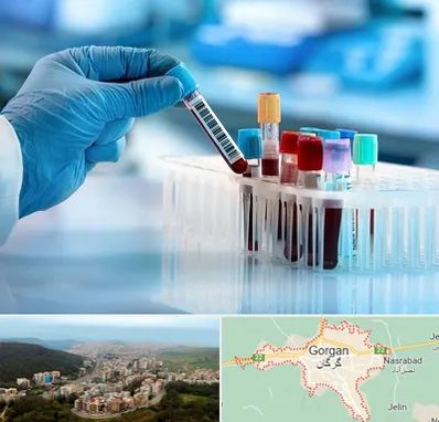 آزمایشگاه خون قبل از ازدواج در گرگان