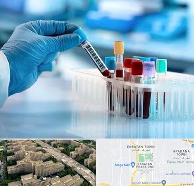 آزمایشگاه خون قبل از ازدواج در اکباتان 