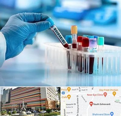 آزمایشگاه خون قبل از ازدواج در سهروردی 