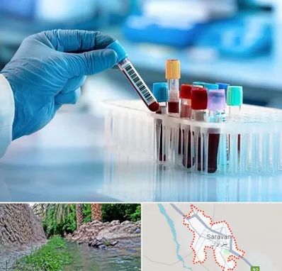 آزمایشگاه خون قبل از ازدواج در سراوان