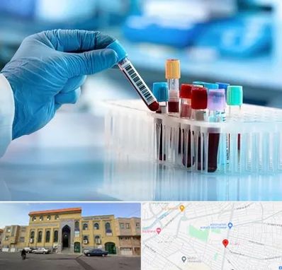 آزمایشگاه خون قبل از ازدواج در زنبیل آباد قم