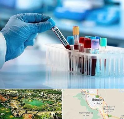 آزمایشگاه خون قبل از ازدواج در بروجرد