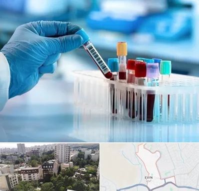 آزمایشگاه خون قبل از ازدواج در اوین