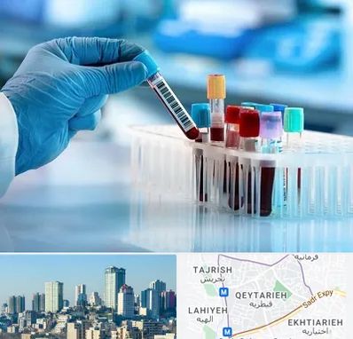 آزمایشگاه خون قبل از ازدواج در قیطریه 
