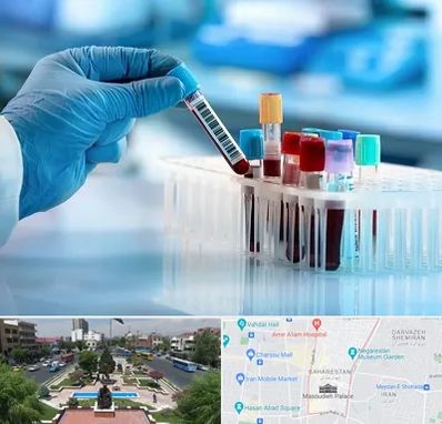 آزمایشگاه خون قبل از ازدواج در بهارستان 