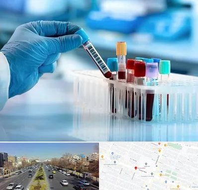آزمایشگاه خون قبل از ازدواج در بلوار معلم مشهد