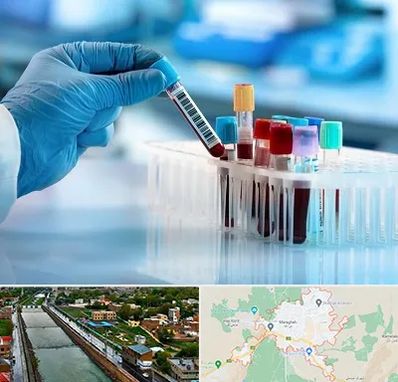آزمایشگاه خون قبل از ازدواج در مراغه