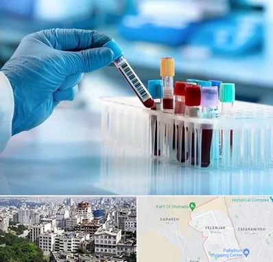 آزمایشگاه خون قبل از ازدواج در ولنجک 