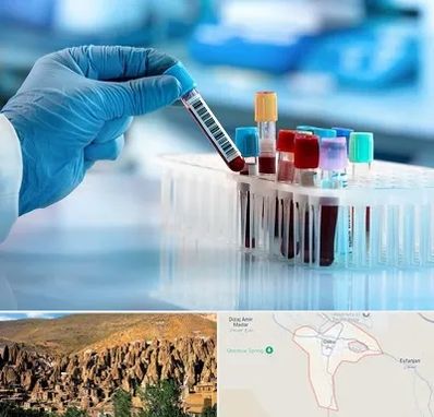 آزمایشگاه خون قبل از ازدواج در اسکو