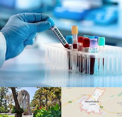 آزمایشگاه خون قبل از ازدواج در نیشابور