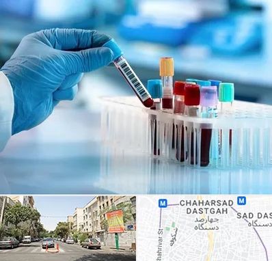 آزمایشگاه خون قبل از ازدواج در چهارصد دستگاه 