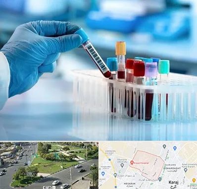 آزمایشگاه خون قبل از ازدواج در شاهین ویلا کرج