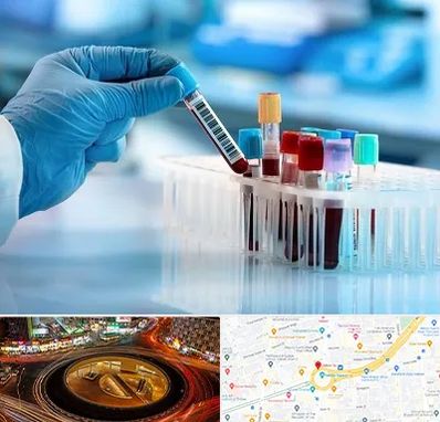 آزمایشگاه خون قبل از ازدواج در میدان ولیعصر 